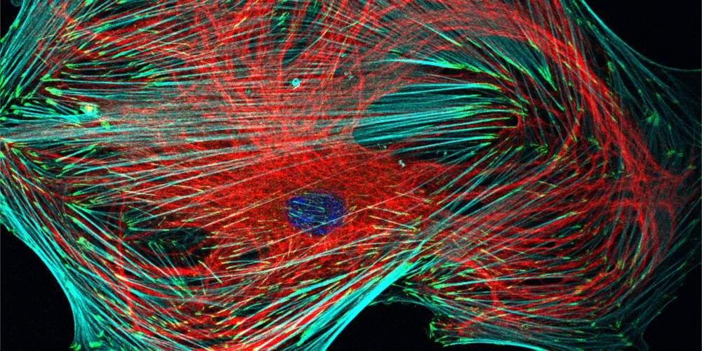 Cytoskeletal organization in a cancer-associated fibroblast