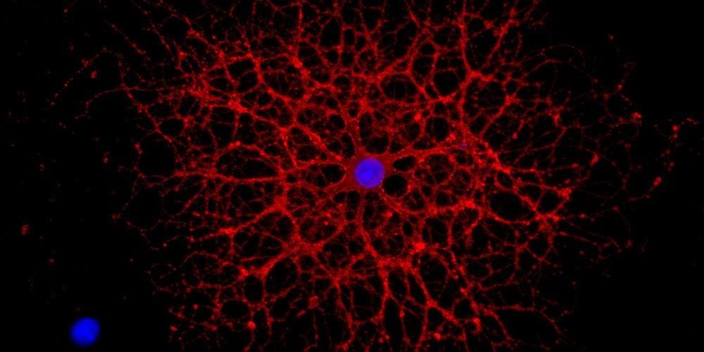 Differentiated oligodendrocyte, the myelin sheath forming cells of the CNS