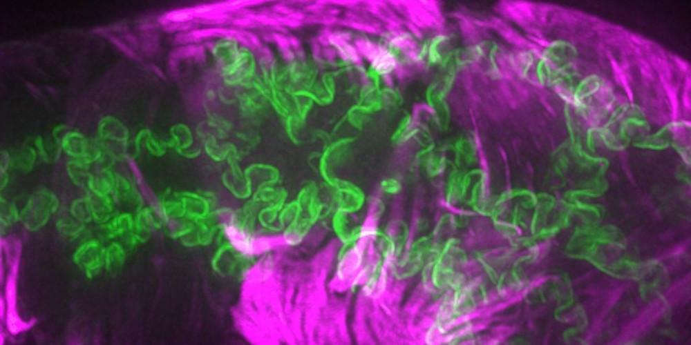 Cell-cell junctions (green) and actin filament bundles (magenta) in the worm spermatheca