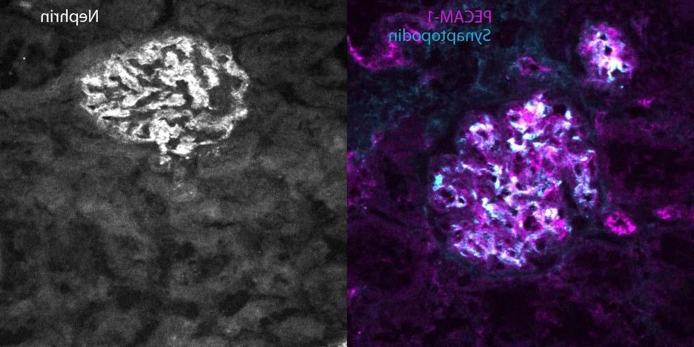 Immunofluorescence staining